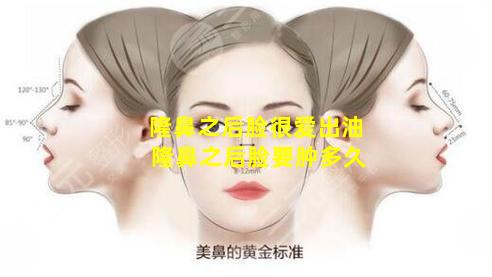 隆鼻之后脸很爱出油 隆鼻之后脸要肿多久